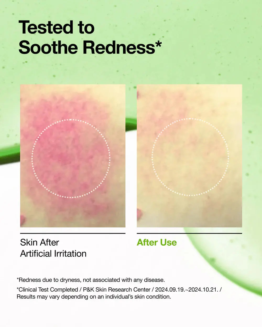 Anua Azelaic Acid 10 Hyaluron Redness Soothing Serum, volgens het merk getest op het kalmeren van roodheid door droogte