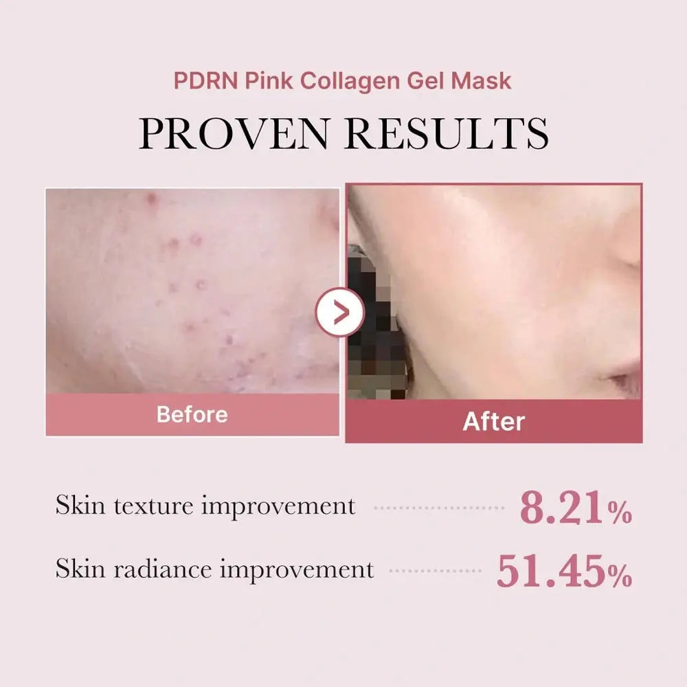Medicube PDRN Pink Collagen Gel Mask, volgens het merk huidtextuur +8,21% en uitstraling +51,45%