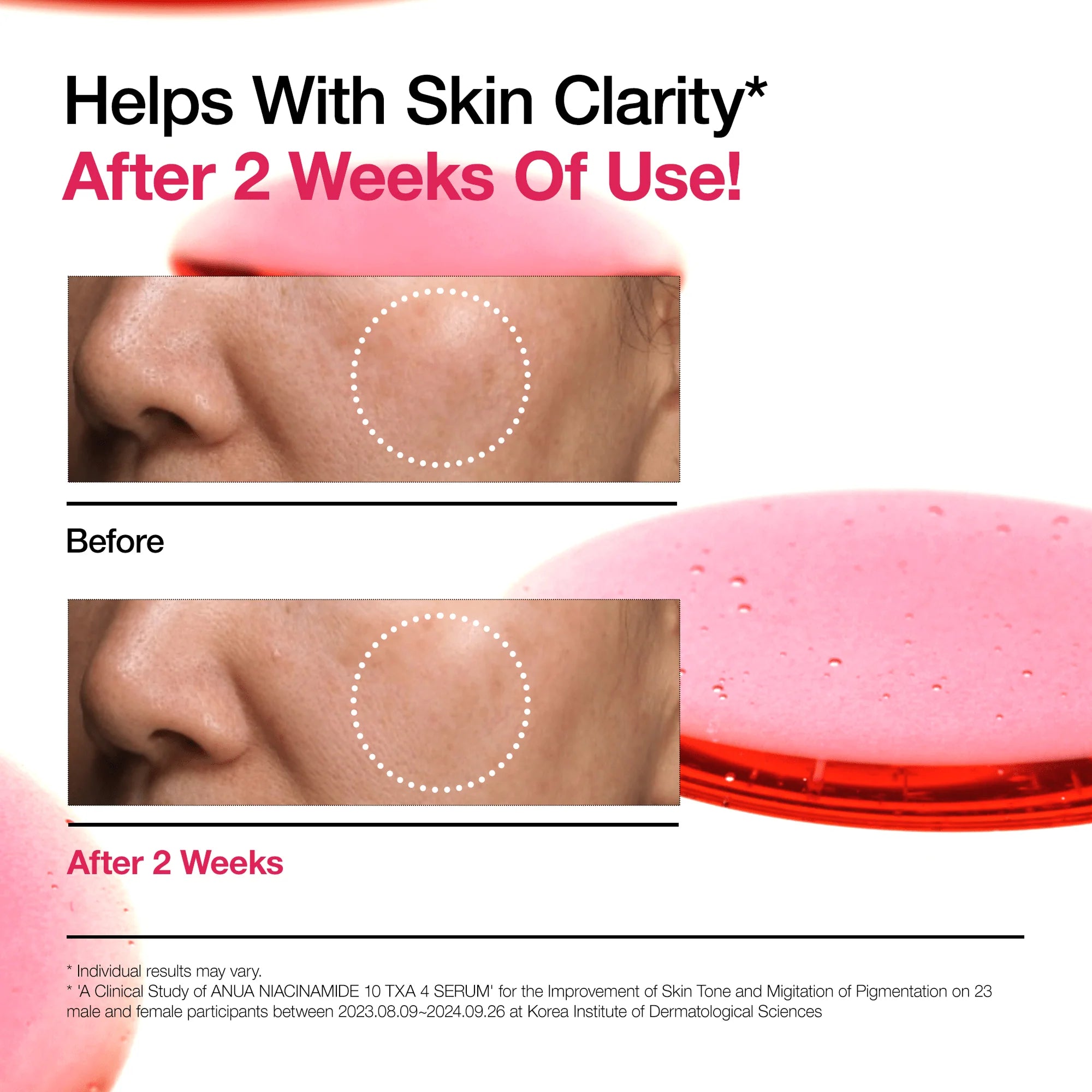 Anua Niacinamide Serum voor en na resultaat - verbeterde huidtextuur na 2 weken gebruik