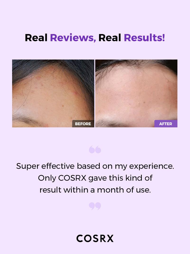COSRX - AHA/BHA Clarifying Treatment Toner 150ml - Korean skincare - Nashwa