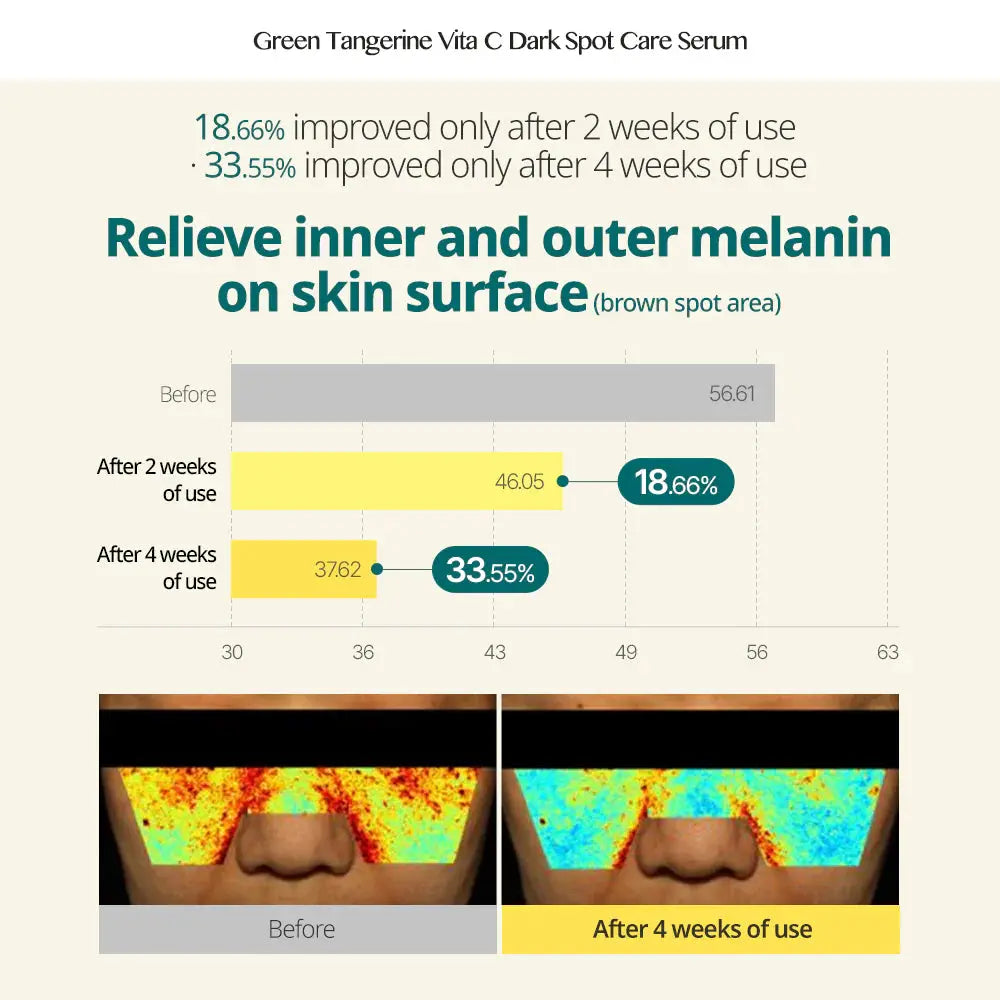 Goodal Green Tangerine Vita C Dark Spot Care Serum, volgens het merk 33,55% minder bruine vlekjes na 4 weken