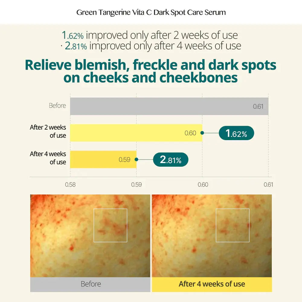 Goodal Green Tangerine Vita C Dark Spot Care Serum, volgens het merk 2,81% minder vlekjes op wangen na 4 weken