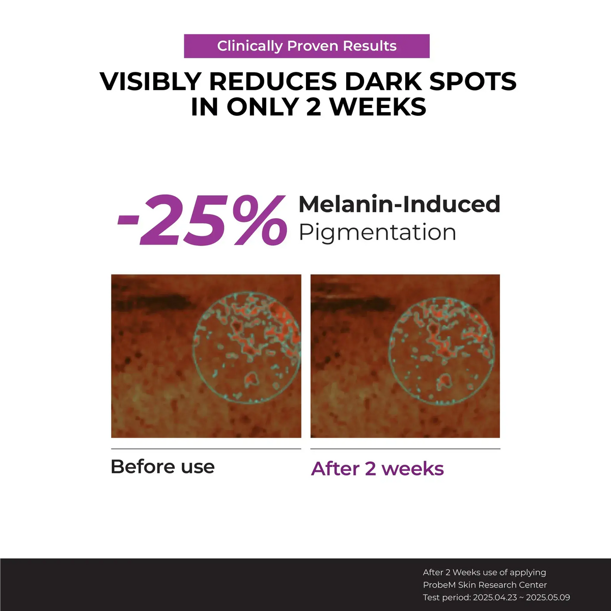 JUMISO Niacinamide 20% Serum, volgens het merk 25% minder pigmentvlekken na 2 weken