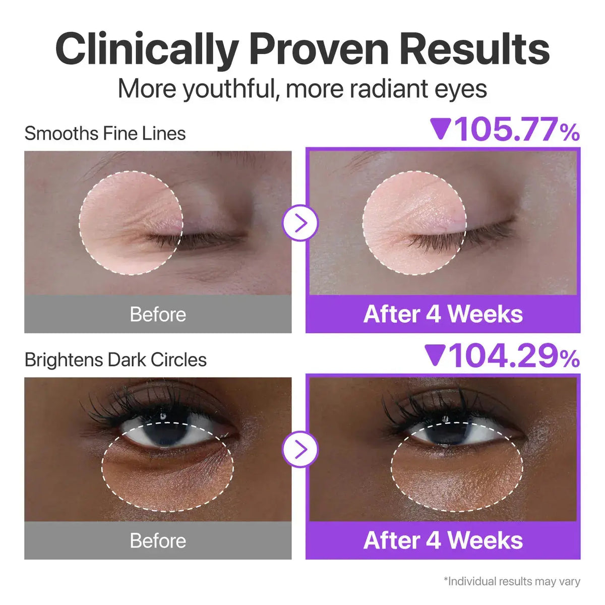 Numbuzin No.9 NAD+ Retinol Volumetox Eye Cream, volgens het merk minder fijne lijntjes en lichtere donkere kringen na 4 weken
