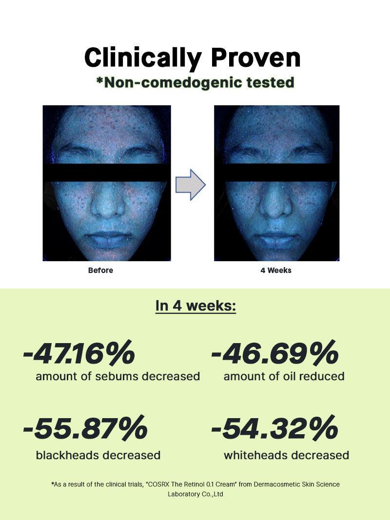 Door het merk geteste talgvermindering van de COSRX The Retinol 0.1 Cream, niet-comedogeen getest