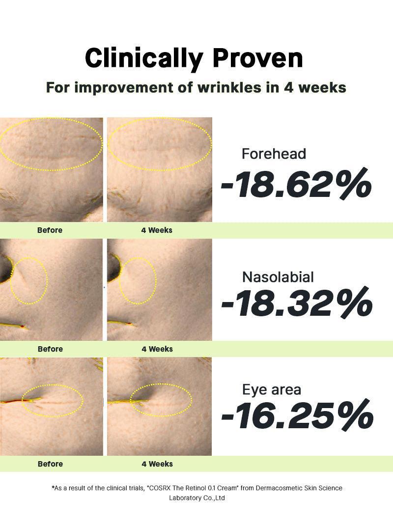 Voor en na van de COSRX The Retinol 0.1 Cream op voorhoofd, neuslippenplooi en oogcontour